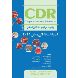 CDR ایمپلنت دندانی میش 2021 